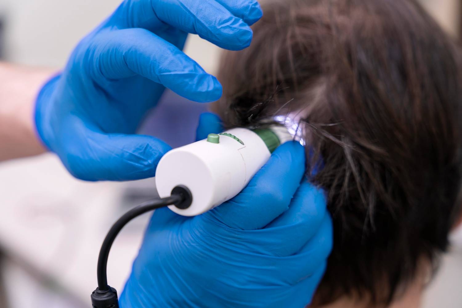 Low light laser therapy in panvel at dermaplast cliinic
