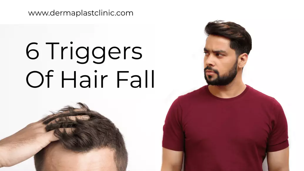 6-Triggers-of-Hair-Fall