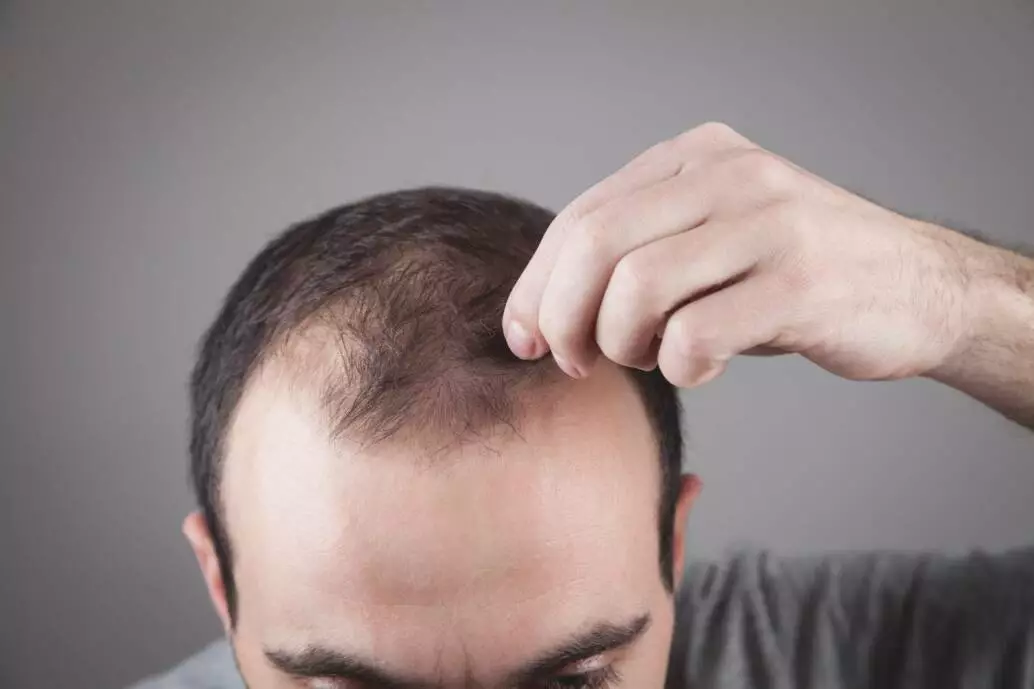 best hair transplant in panvel