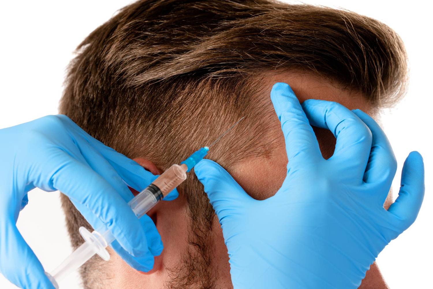 closeup-doctor-s-hand-with-syringe-man-receiving-scalp-injection-hair-grow (1)