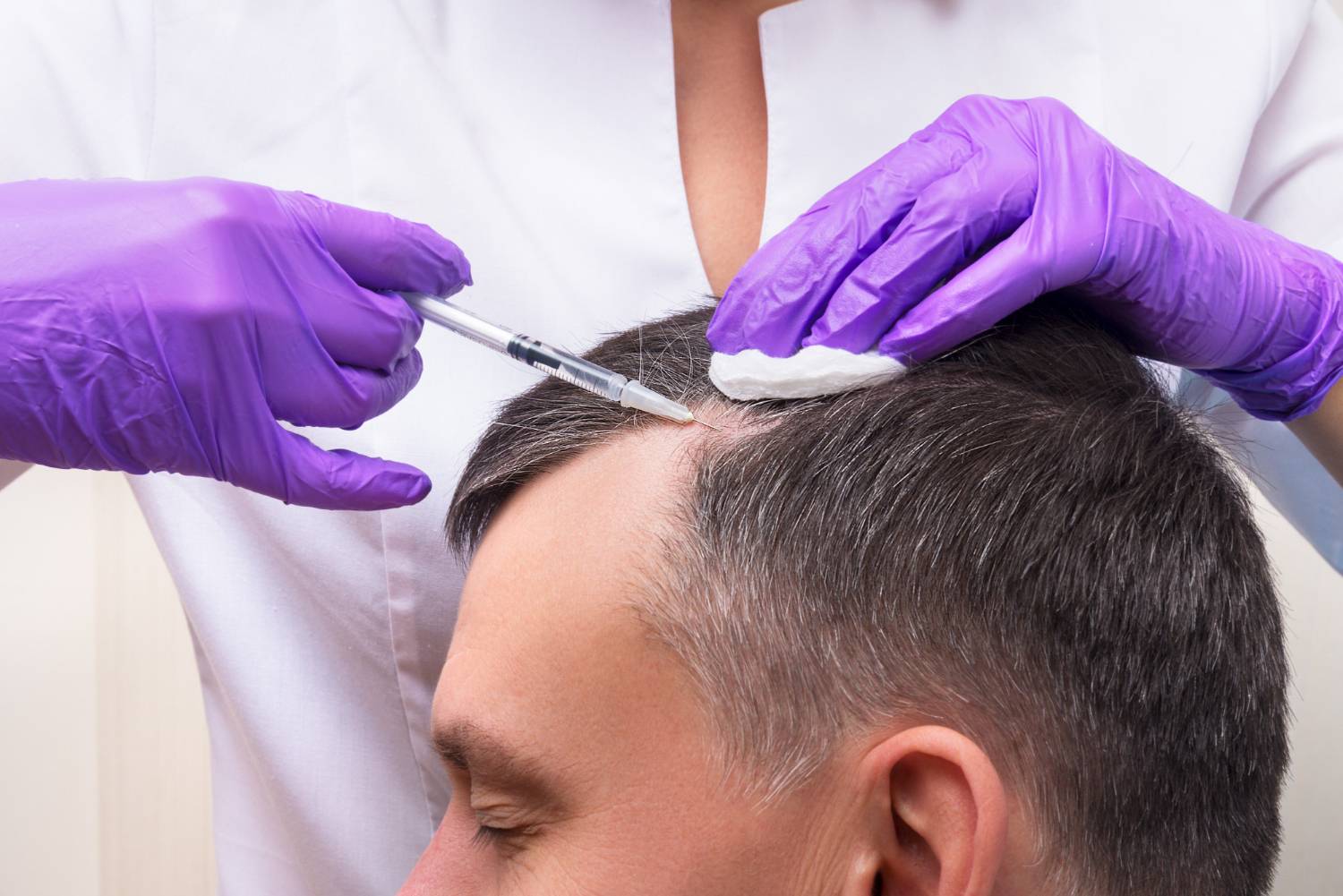 injection-treatment-hair-loss