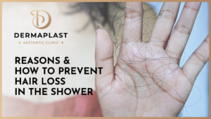 How to Prevent Hair Loss In The Shower