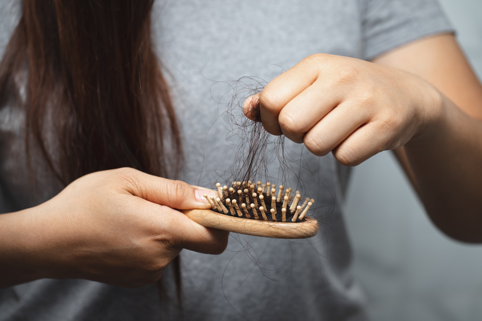 Women's hair loss problems