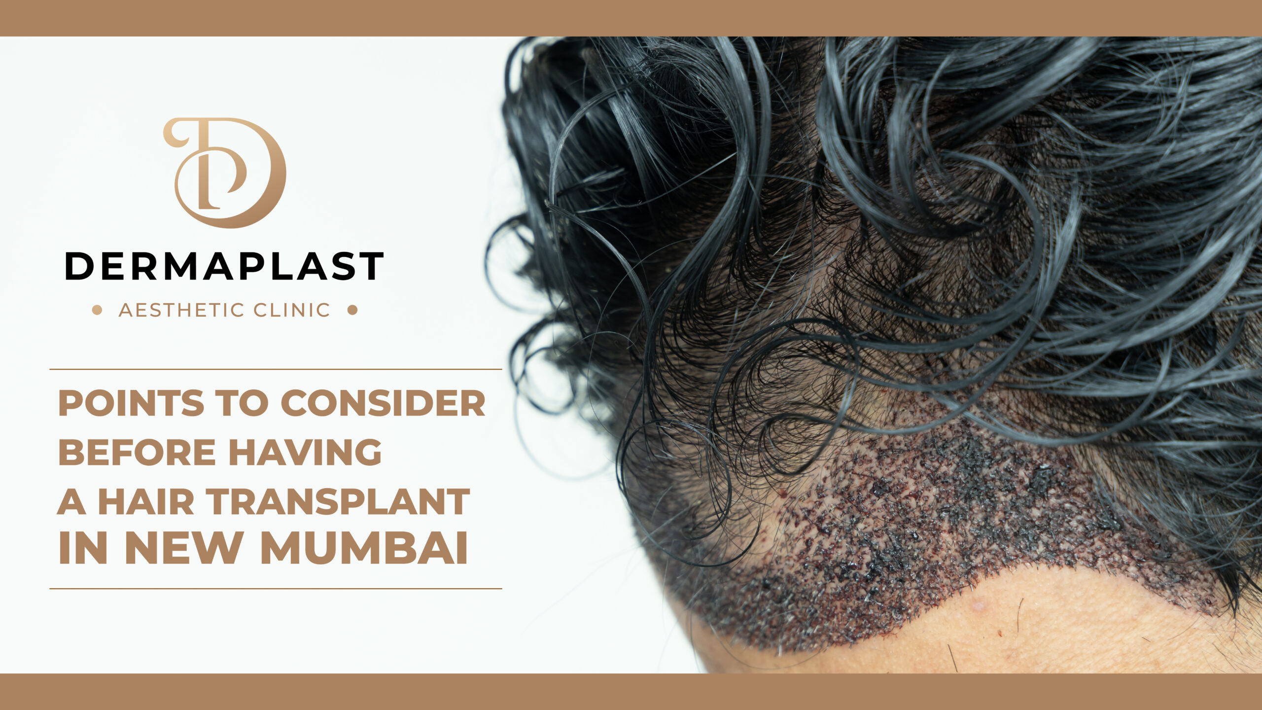 hair transplant in new mumbai