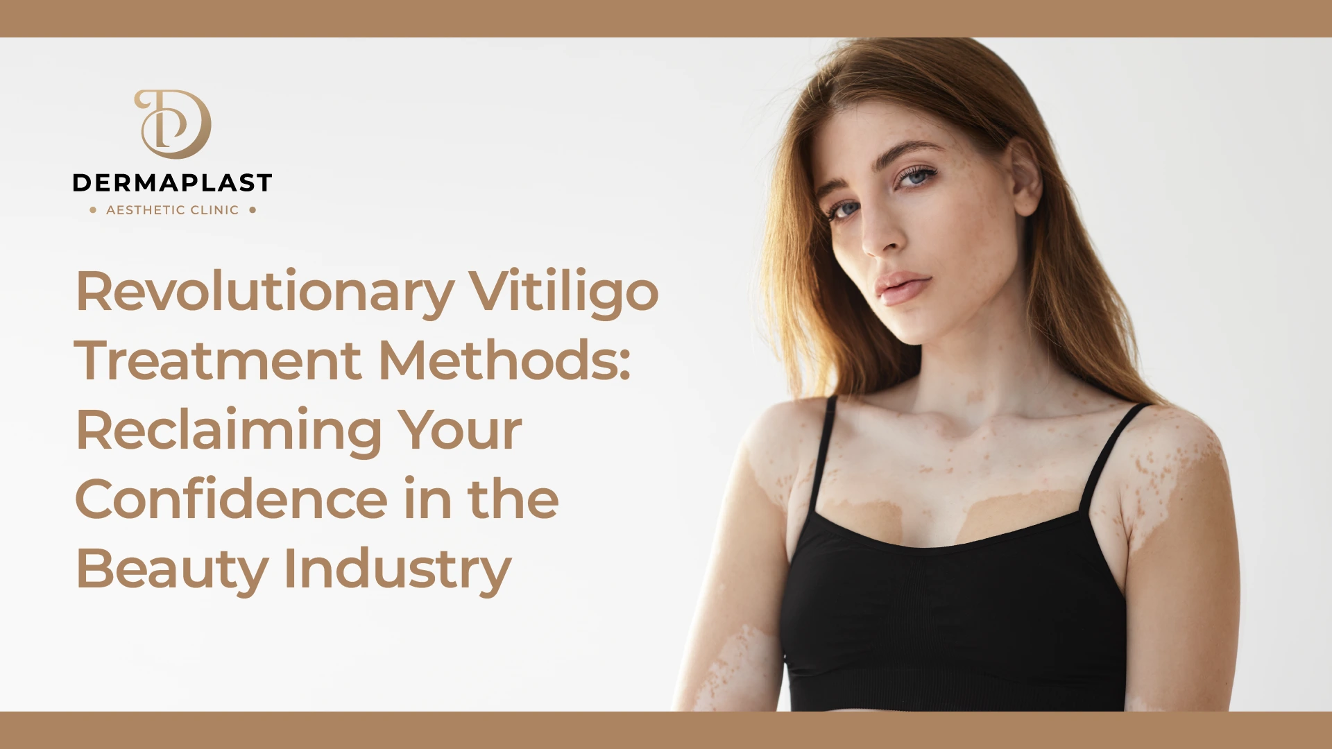 Revolutionary Vitiligo Treatment Methods: Reclaiming Your Confidence in the Beauty Industry