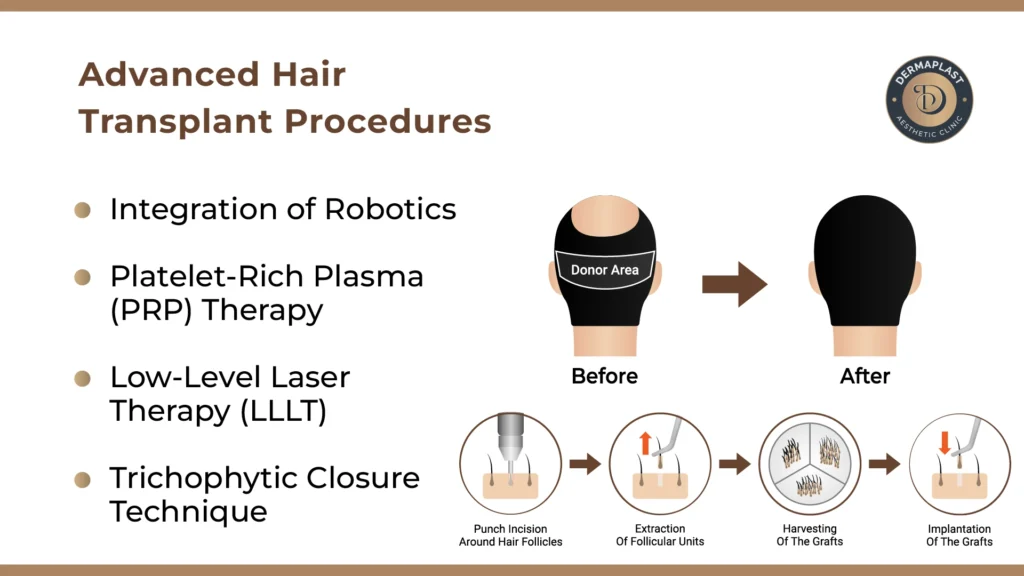 Advanced Hair Transplant Procedures