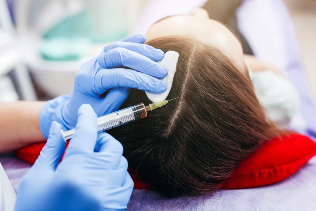 Non-Surgical Hair Restoration