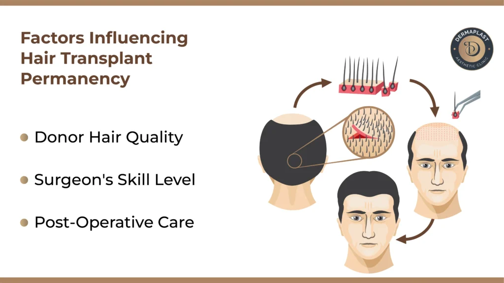 Factors Influencing Hair Transplant Permanency, Hair Transplant Clinic in Mumbai